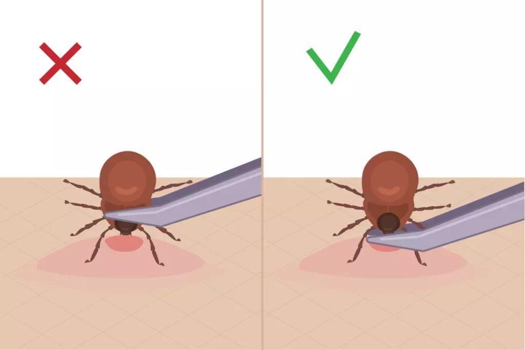 Comment enlever une tique efficacement ?